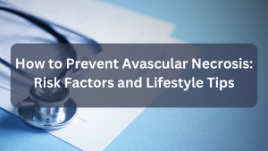 How to Prevent Avascular Necrosis: Risk Factors and Lifestyle Tips