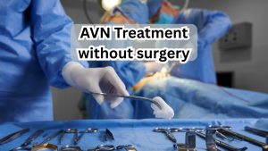 Avn Treatment without surgery