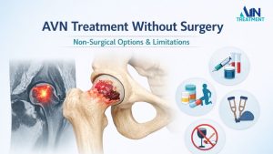 AVN treatment without surgery showing early-stage avascular necrosis of the hip and non-surgical treatment options.